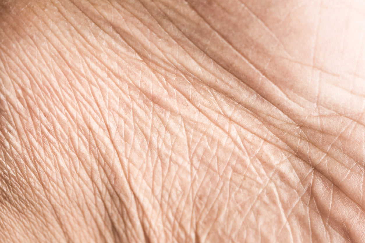 Crepey Skin: Causes, Symptoms, and Effective Treatment Options