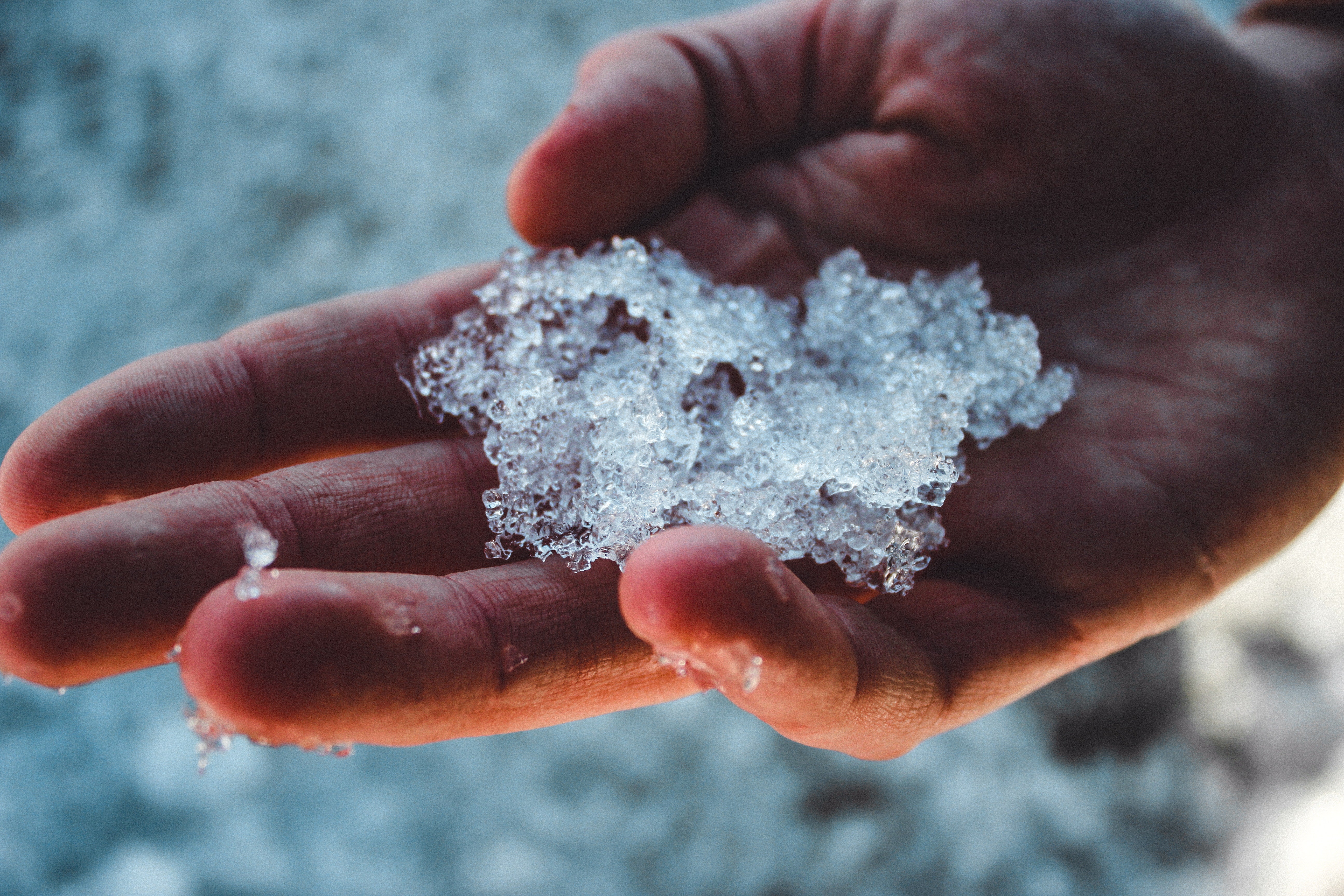 Skin Conditions Caused by Ice: A Guide to Prevention and Treatment