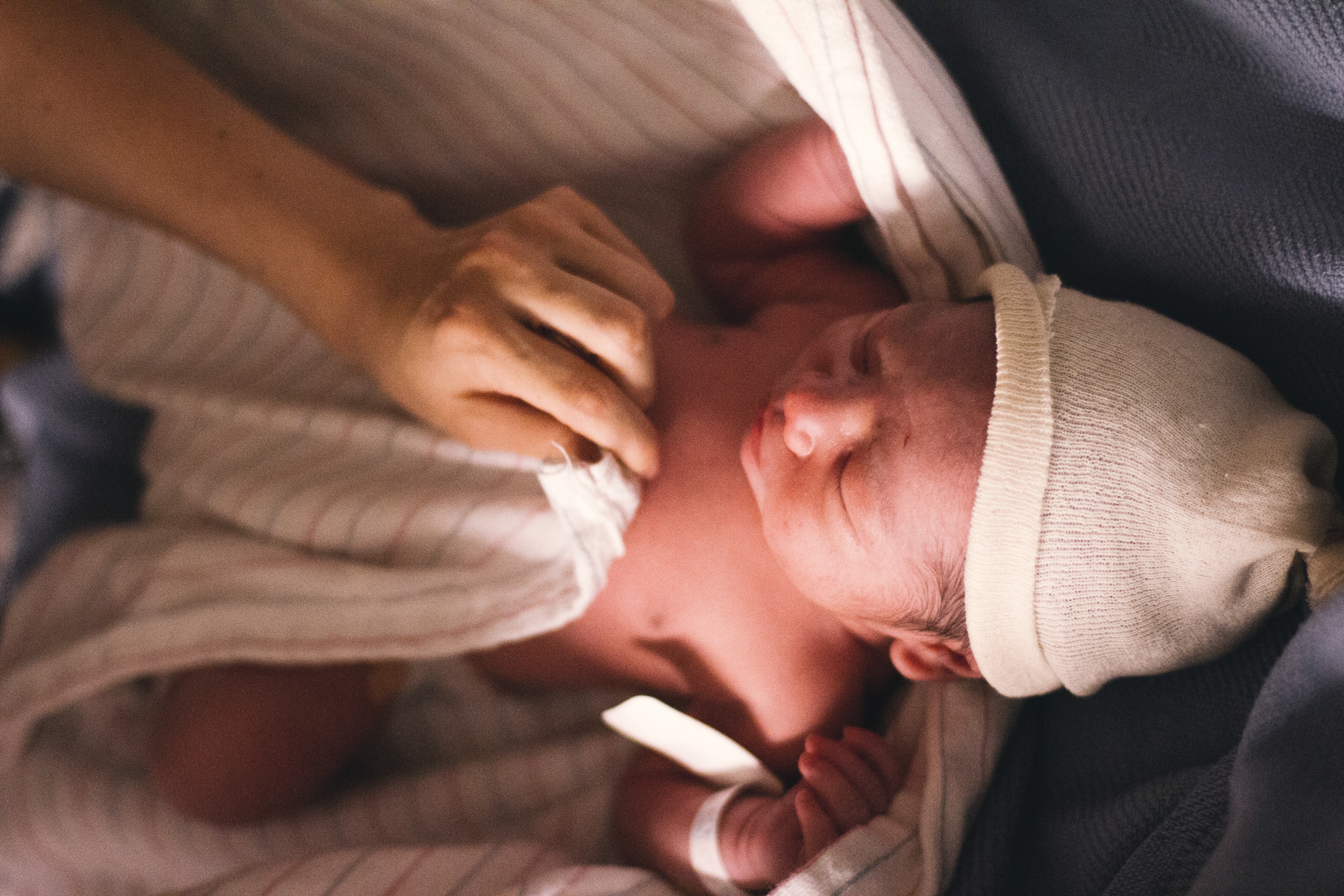 Newborn Skin Conditions: Identification, Treatment, and Prevention