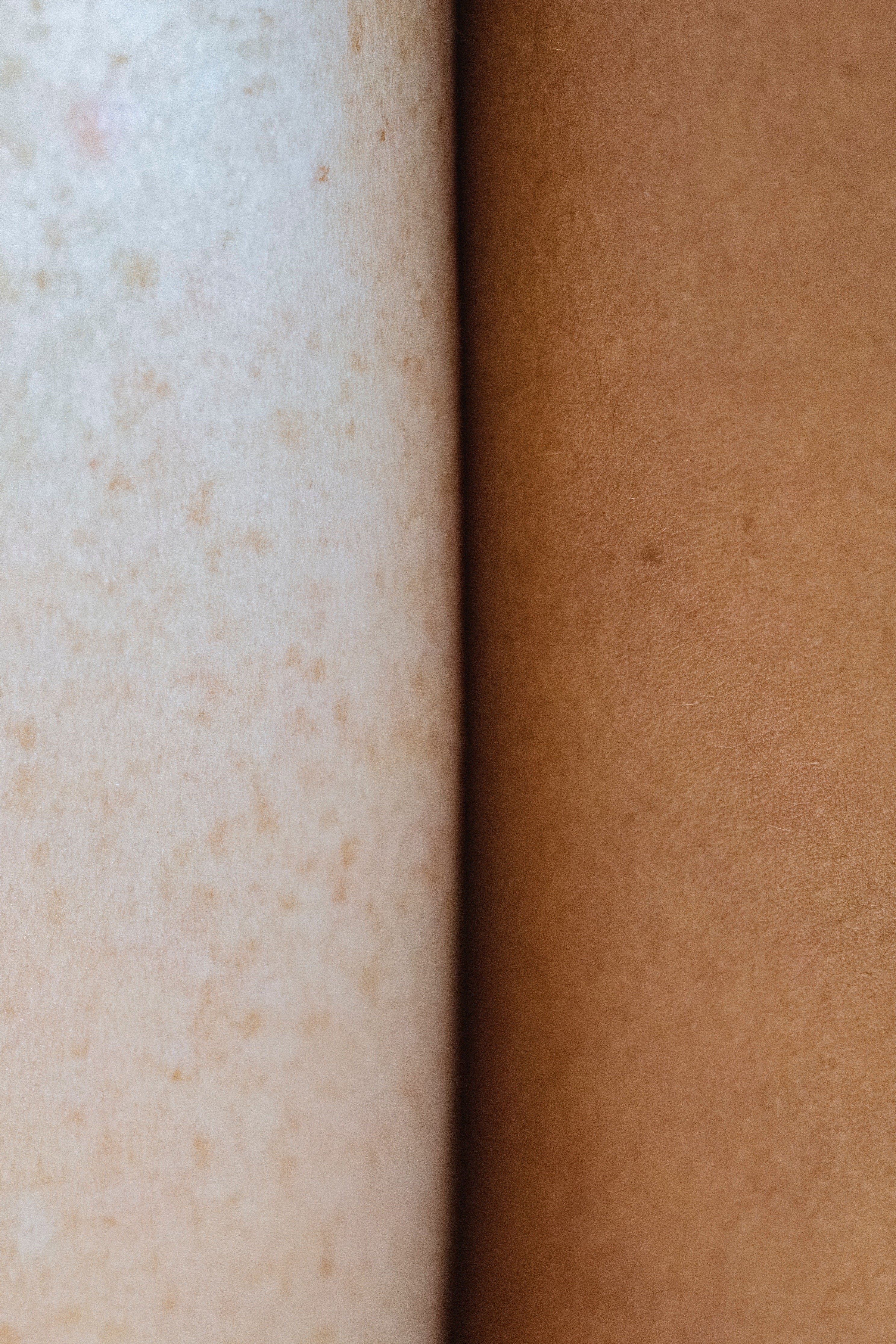Understanding and Addressing Uneven Skin Tone: A Complete Guide